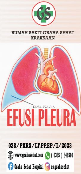 EFUSI PLEURA