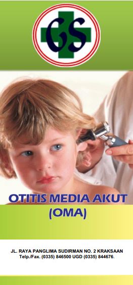 OTITIS MEDIA AKUT
