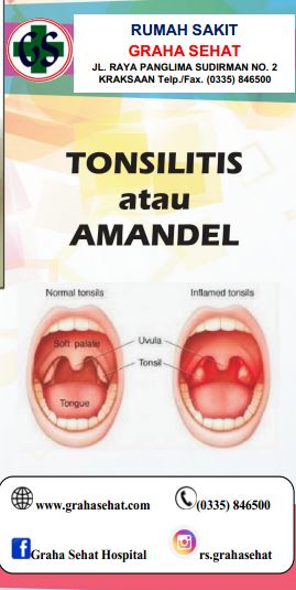 TONSILITIS ATAU AMANDEL