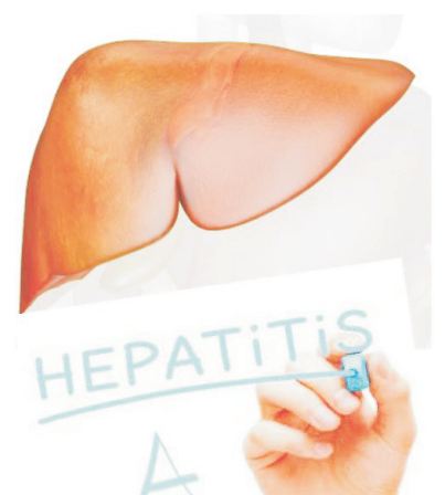 HEPATITIS