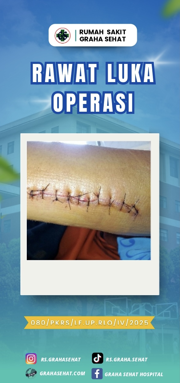 RAWAT LUKA OPERASI